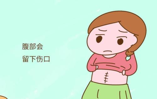 剖腹产生四胎的多吗_梦见二胎剖腹产生女孩_剖腹产生子择日